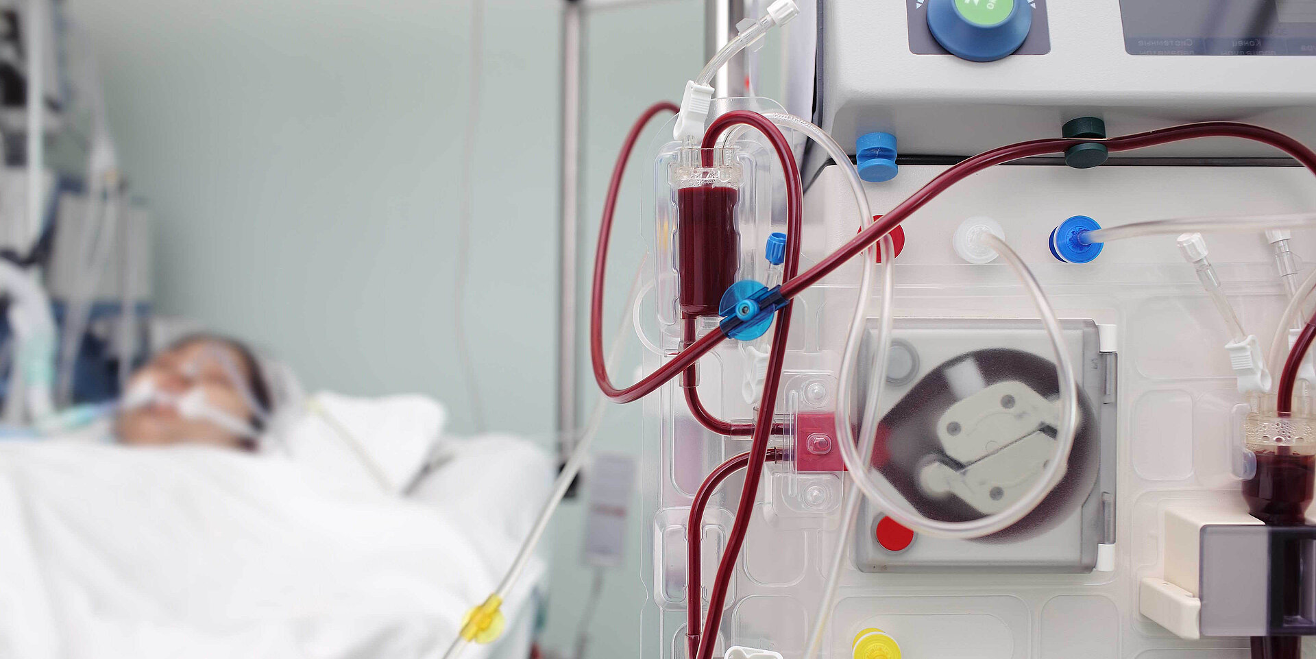 Máquina de diálisis que atiende a un paciente